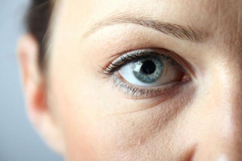 Relleno de Ojeras con Ácido Hialurónico