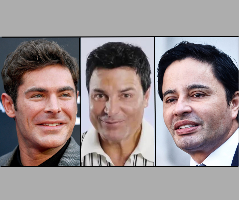 botox Zac Efron, botox Chayanne y botox Rodolfo Carter