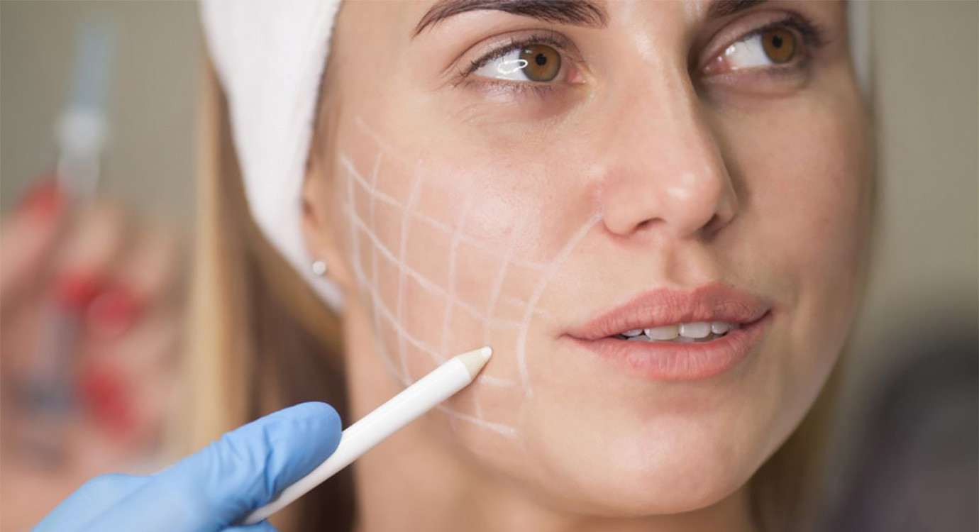 ¿Qué es mejor: Ácido Hialurónico o Botox?